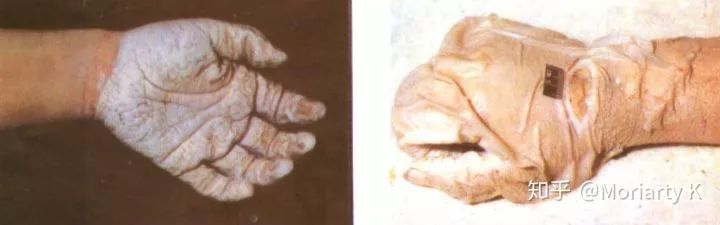 犯罪心理學(xué)：水塘中的碎腐之尸，是受害者亦是施暴者