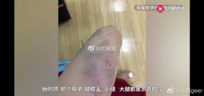 女教師遭家暴跳樓身亡：被逼到什么地步，才會以死解脫？