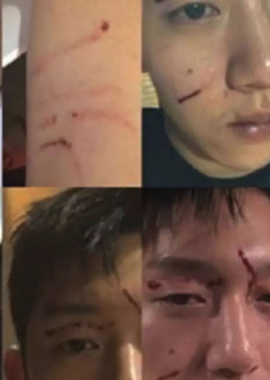 美麗，富有，年少成名，她為何選擇死亡？