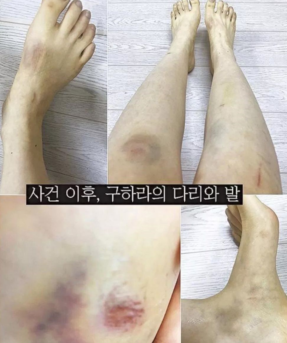 美麗，富有，年少成名，她為何選擇死亡？