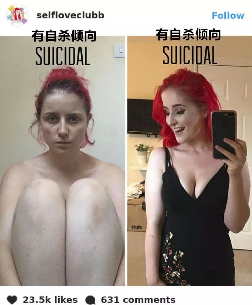 她們都因抑郁癥而死，我希望你開心地活下去