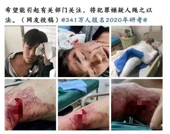 沈陽研究生砍人事件：這三件事，一定要讓孩子知道