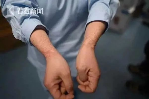 確診老人隱瞞致百余人密切接觸：比病毒更可怕的，是人心