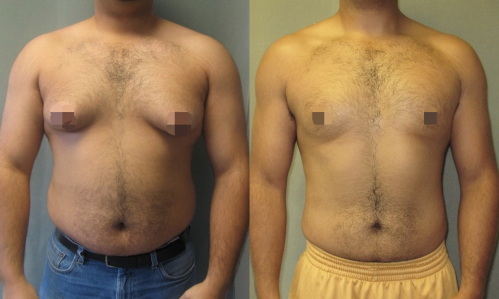 男人的乳頭，能用來「父乳喂養(yǎng)」嗎？