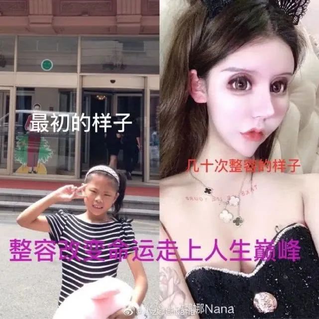 我花了100萬把女兒整成殘廢，病態(tài)審美觀正在摧殘20萬女性