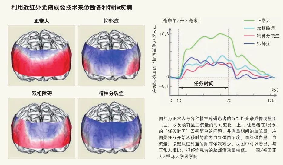 長期心情低落，我是不是抑郁癥了？