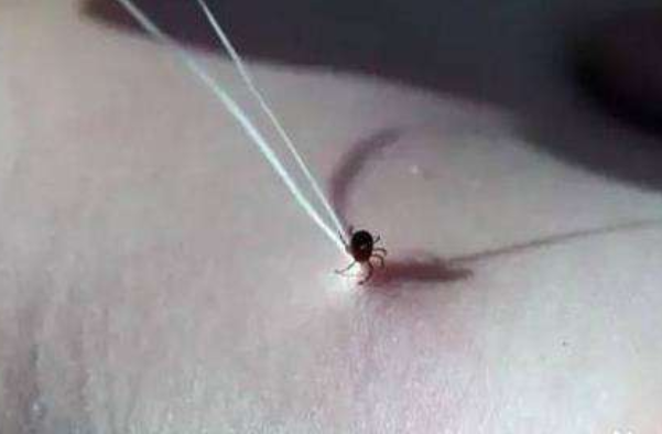 怎么辨別蜱蟲和黑痣
