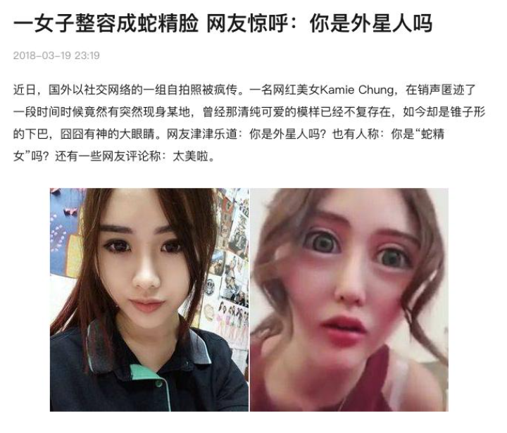 容貌焦慮是病嗎？