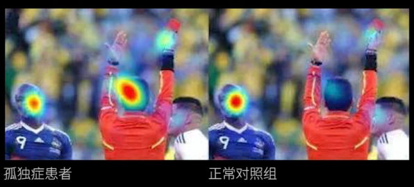 眼動(dòng)地形圖、早期鑒別孤獨(dú)癥孩子的重大發(fā)現(xiàn)